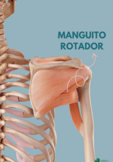 ilustración de lesión en el manguito rotador