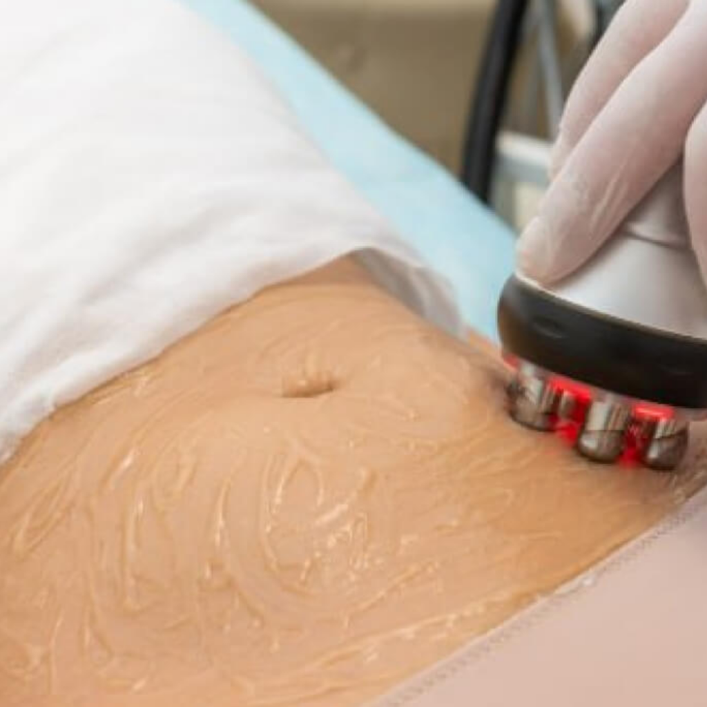 Fisioterapia dermatofuncional 2